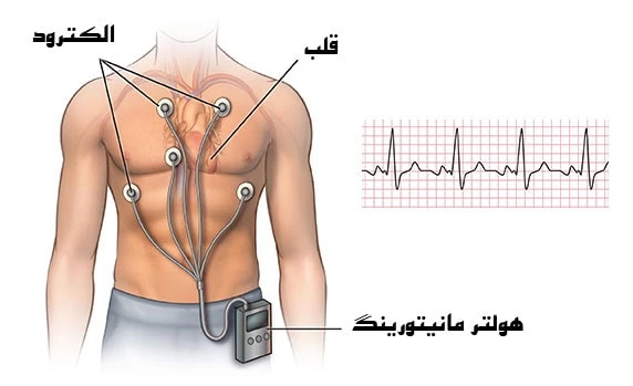 أداء الجهاز-الرسن-