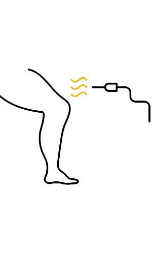 علاج الدوالی بالموجات