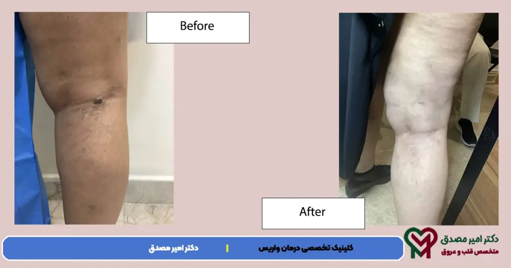 الصورة من الدوالي تانابي