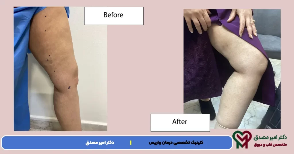 صوره دوالی الأورده عند النساء