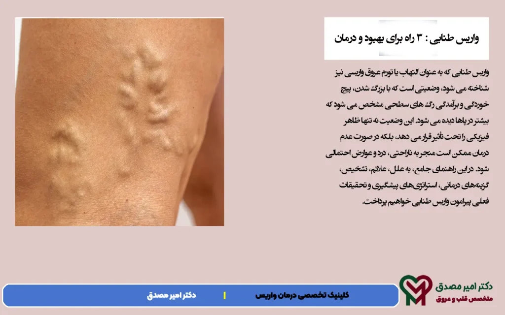 الدوالي تانابي يعني ؟ 