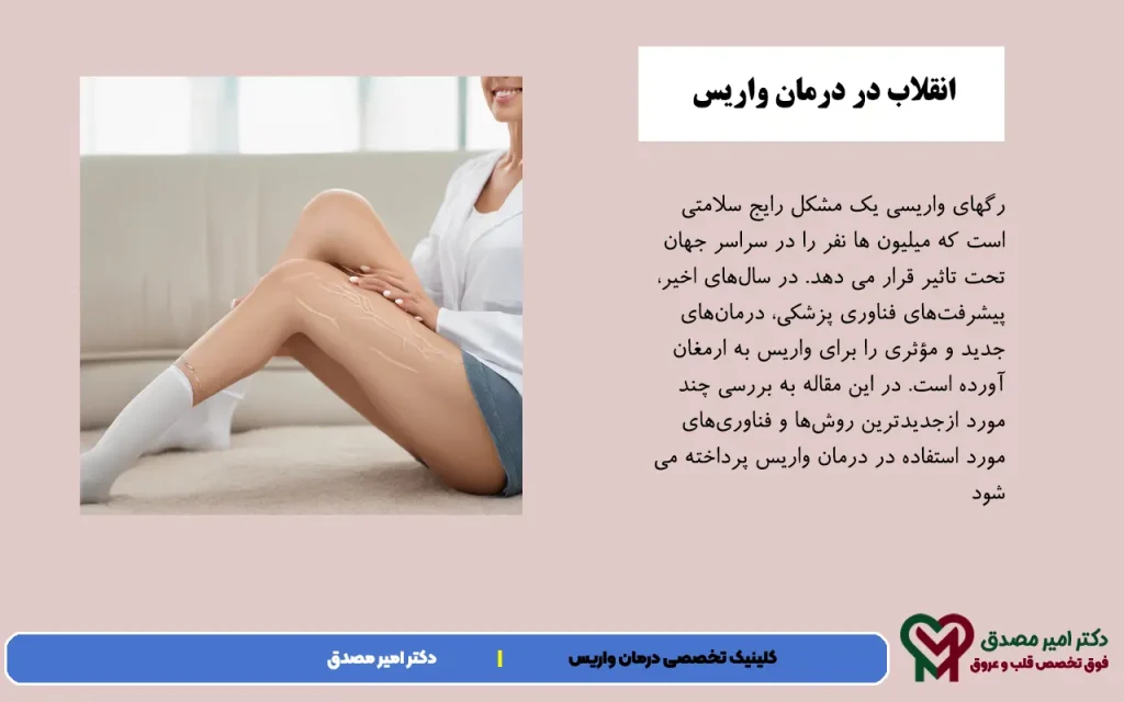 أحدث طرق علاج الدوالي 