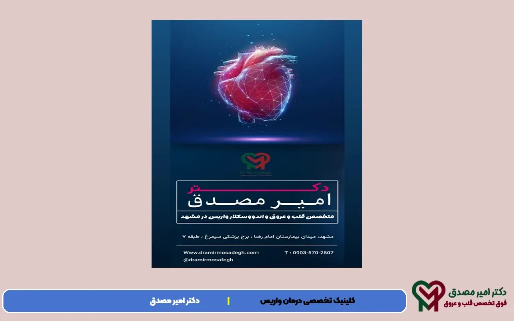 درمان واریس شغلی