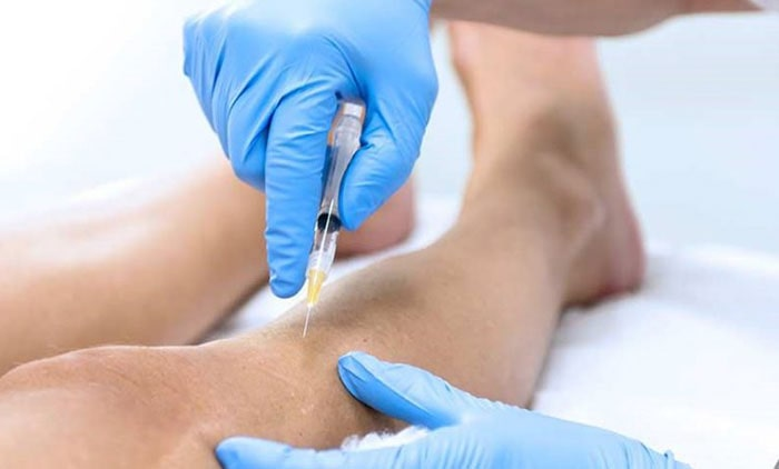 ما هی مضاعفات العلاج بالتصلب؟